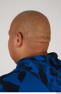 Photos Ernesto Lacasa bald head 0003.jpg